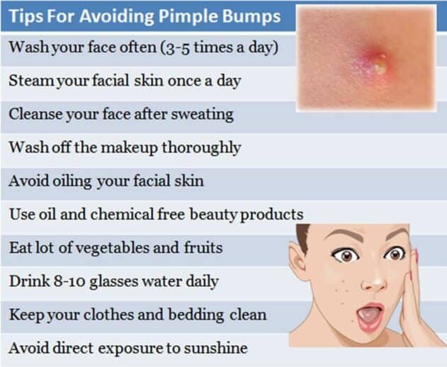 How to Get Rid of Pimples Fast?