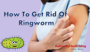ringworm doesn t itch