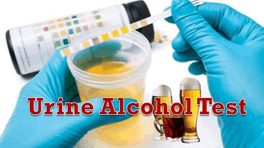 Alcohol Urine Tests At Home at Dale Gillen blog